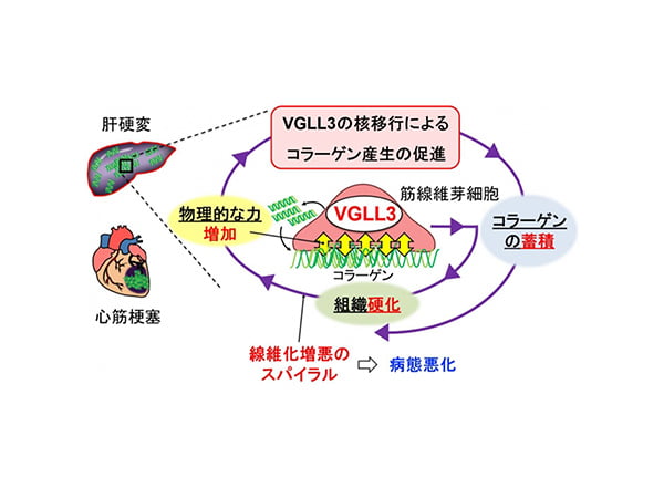 連載シリーズ 新しい資本主義の「扉」第46回心筋梗塞や肝硬変等、不治と言われる病の治療も可能に